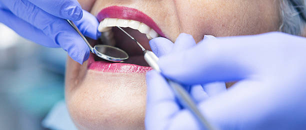 Best Emergency Dental Care for Broken or Chipped Teeth in Yadkinville, NC